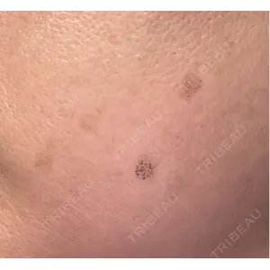 ビラビューティークリニック 小倉美容外科/美容皮膚科 ビラビューティークリニック口コミ