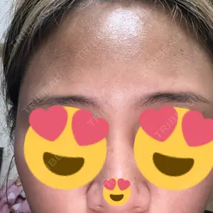 TCB東京中央美容外科 TCB東京中央美容外科 岐阜院口コミ