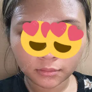 TCB東京中央美容外科 TCB東京中央美容外科 岐阜院口コミ