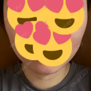 池袋美容クリニック 池袋美容クリニック口コミ