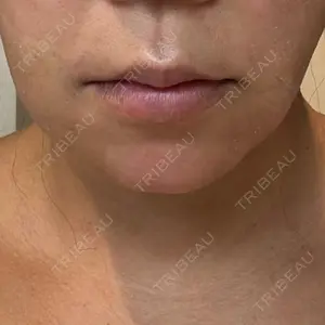 BLINC CLINIC （ブリンク クリニック）口コミ