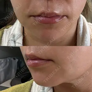 BLINC CLINIC （ブリンク クリニック）口コミ