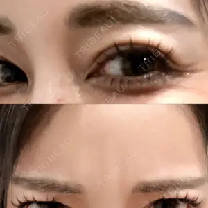 口コミ