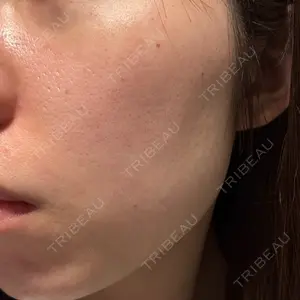 やさしい美容皮膚科・皮フ科 やさしい美容皮膚科・皮フ科　秋葉原院口コミ