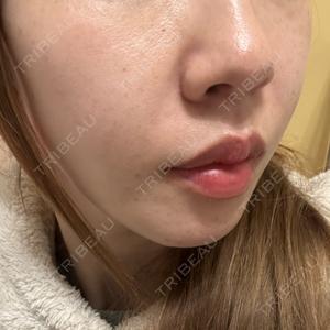 NARU Beauty Clinic NARU Beauty Clinic 【ナルクリ】口コミ