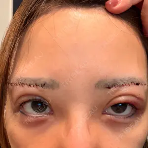 新宿美容外科ネビュラクリニックの