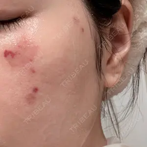 聖心美容クリニック グループ S-Laboクリニック 渋谷院口コミ