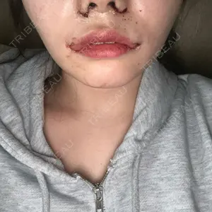 口コミ