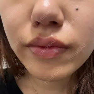 HAAB CLINIC HAAB×DREAM BEAUTY CLINIC 東京本院口コミ