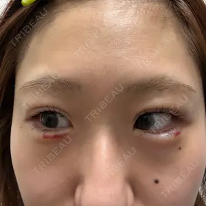 HAAB CLINIC HAAB×DREAM BEAUTY CLINIC 東京本院口コミ