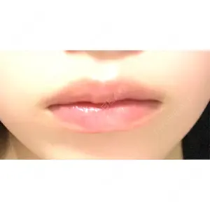 ルラ美容クリニック ルラ美容クリニック 宇都宮院口コミ