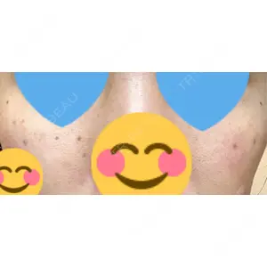 APスキンクリニック銀座口コミ