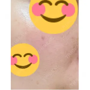 APスキンクリニック銀座口コミ