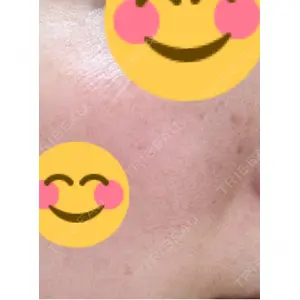 APスキンクリニック銀座口コミ