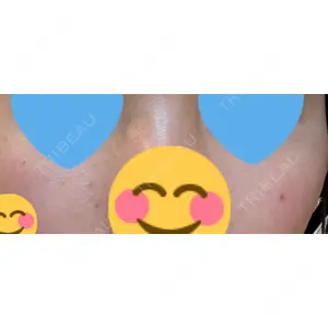 APスキンクリニック銀座口コミ