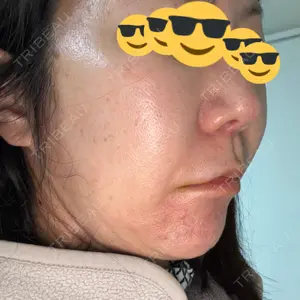 おおかみ美容のクリニック おおかみ美容のクリニック 新宿院口コミ