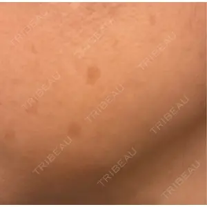 ビラビューティークリニック 小倉美容外科/美容皮膚科 ビラビューティークリニック口コミ