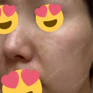 APスキンクリニック銀座口コミ