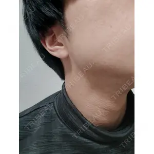 白金ビークリニック 本院口コミ