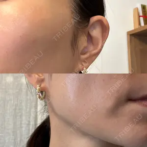トラスト美容クリニック トラスト美容クリニック 銀座院口コミ