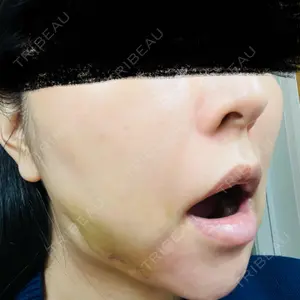 HAAB CLINIC HAAB×DREAM BEAUTY CLINIC 東京本院口コミ