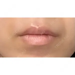 美容皮膚科ティファクリニック 美容皮膚科ティファクリニック 新宿東口口コミ