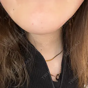 新宿美容外科ネビュラクリニックの