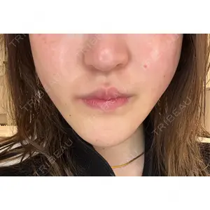 新宿美容外科ネビュラクリニックの