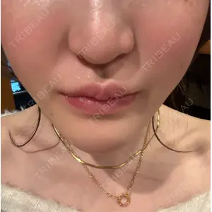 新宿美容外科ネビュラクリニックの