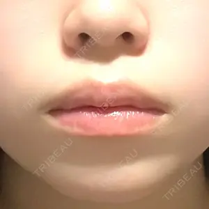 口コミ