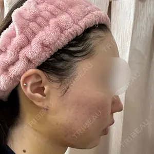藤・ナチュレ美容クリニック 藤・ナチュレ美容クリニック 銀座院口コミ