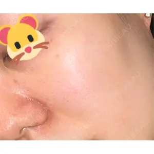 APスキンクリニック銀座口コミ