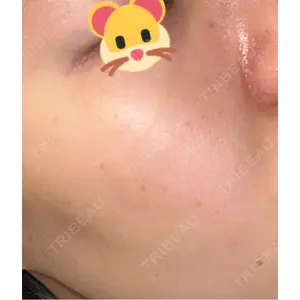 APスキンクリニック銀座口コミ