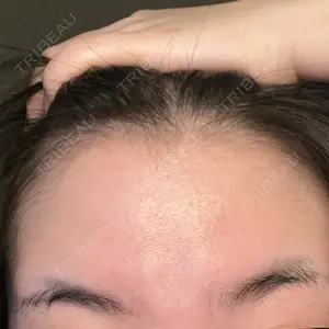 池袋美容クリニック 池袋美容クリニック口コミ