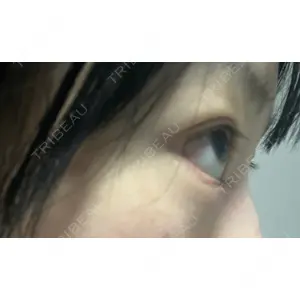 LEX BEAUTY CLINIC LEX BEAUTY CLINIC口コミ
