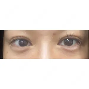 HAAB CLINIC HAAB BEAUTY CLINIC 名古屋院口コミ