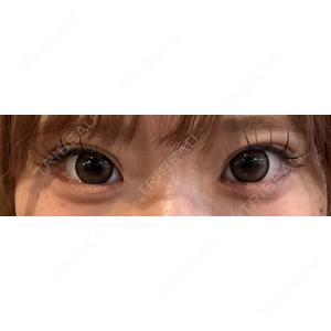 口コミ