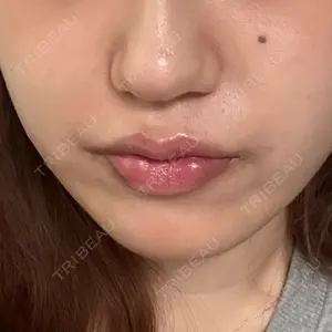 HAAB CLINIC HAAB×DREAM BEAUTY CLINIC 東京本院口コミ