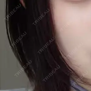 アールクリニック アールクリニック口コミ