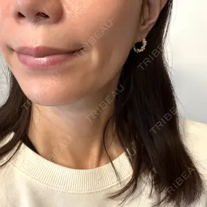 トラスト美容クリニック トラスト美容クリニック 銀座院口コミ