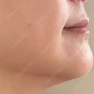 口コミ