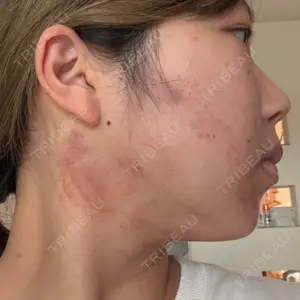 ビラビューティークリニック 小倉美容外科/美容皮膚科 ビラビューティークリニック口コミ