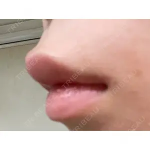 口コミ