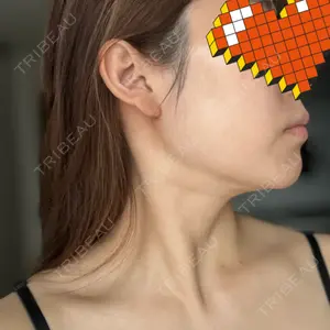 藤・ナチュレ美容クリニック 藤・ナチュレ美容クリニック 銀座院口コミ