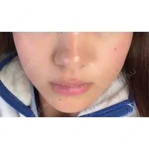 ヴァージンクリニック ヴァージンクリニック 京都院口コミ