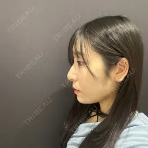 YBC横浜美容外科 YBC横浜美容外科 立川院口コミ