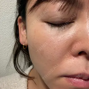 やさしい美容皮膚科・皮フ科 やさしい美容皮膚科・皮フ科　秋葉原院口コミ