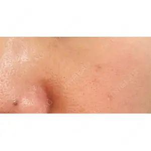 Fellez Clinic【フェルズクリニック】口コミ