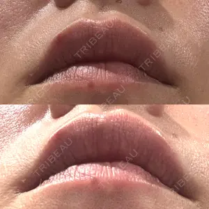 AZ BEAUTY CLINIC口コミ
