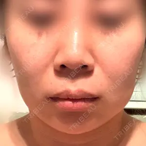 聖心美容クリニック グループ S-Laboクリニック 渋谷院口コミ